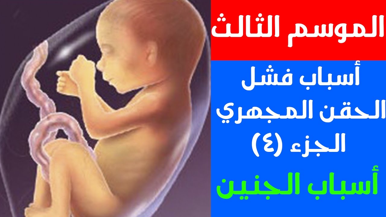 تكرار فشل الحقن المجهري بسبب الجنين ٤ - الموسم الثالث - الحلقة الرابعة - د أحمد حسين