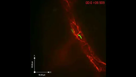 Borrelia burgdorferi sticking to a blood vessel wall in a live mouse