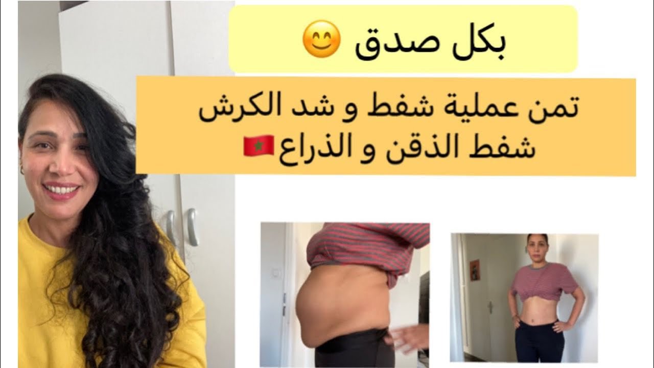 تمن عملية شفط البطن و الشد + شفط الذراع و الذقن المزدوج