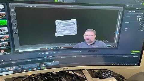 3D Scanning Foot Orthoses