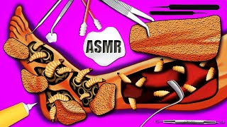 ASMR Animation Deep clenning dirty leg part 2 treatment removal worms and maggot asmr