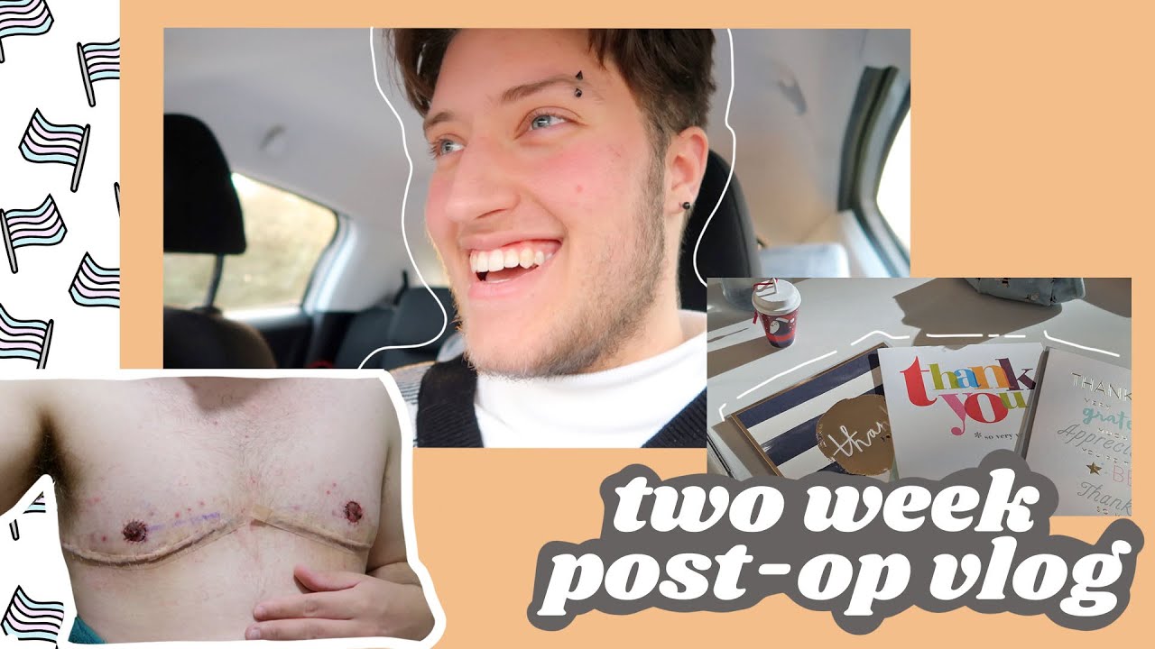 top surgery two weeks post-op vlog || FTM trans