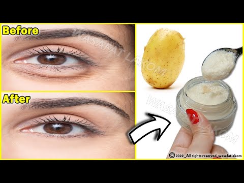 In 3 days Remove Under Eye Bags Completely | Remove Dark Circle, Wrinkles, Puffy Eyes