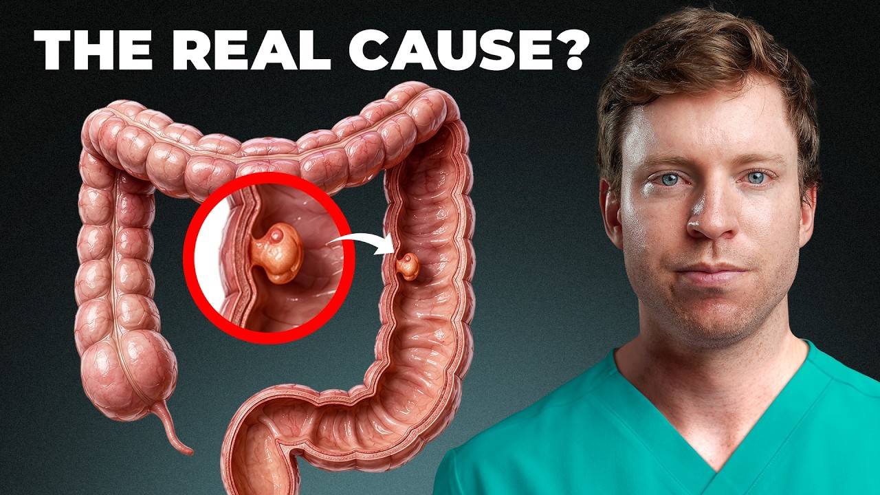 What’s Causing Colon Cancer to Rise So Fast?