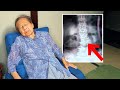 I Broke My Back Fracture...