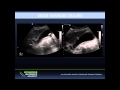 Ultrasound Podcast - Tissue Harmonics