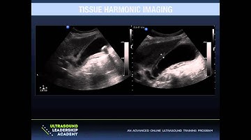 Ultrasound Podcast - Tissue Harmonics