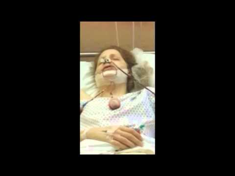 Mon Opération Maxillo Facial 