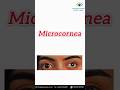 Child eye specialist in ratlam | Best Eye Doctor for Kids Ratlam
