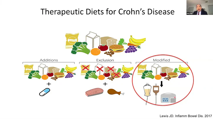 Personalization of the Human Gut Microbiome Respon...