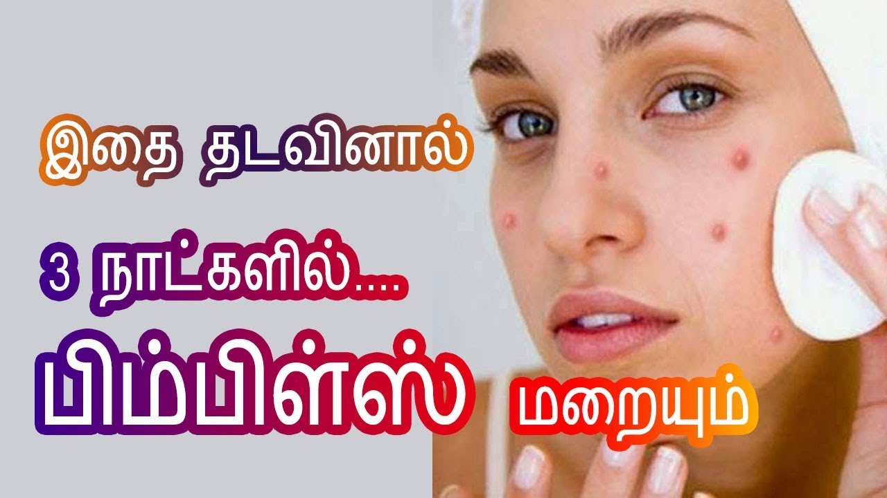 Pimple removal Home remedies in Tamil Beauty Tips to remove pimples at