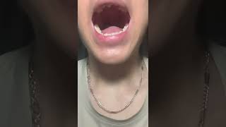 Throw Candy And Gulp It