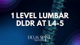 1 Level Lumbar Deuk Laser Disc Repair at L4-5 screenshot 3