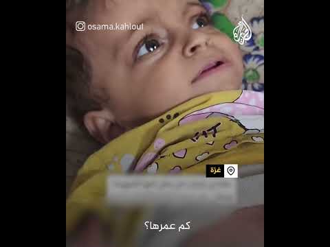 ولدت في الحرب.. معاناة مستمرة لطفلة خرجت من رحم والدتها الشهيدة في غزة