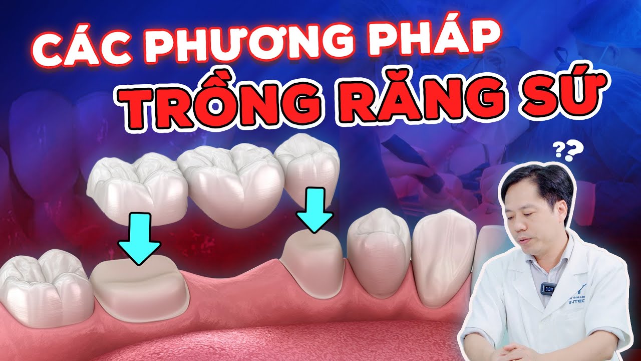 Outline Video Top 2 Phương Pháp Trồng Răng Sứ Mới Nhất? Đâu Là Giải Pháp Kinh Tế Và Hiệu Quả Khi Trồng Răng Sứ