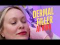 Dermal Filler Treatment at Viva Vitality Medspa