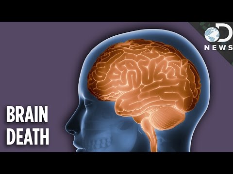 Is A Brain Dead Person Actually Dead? - Kundunya