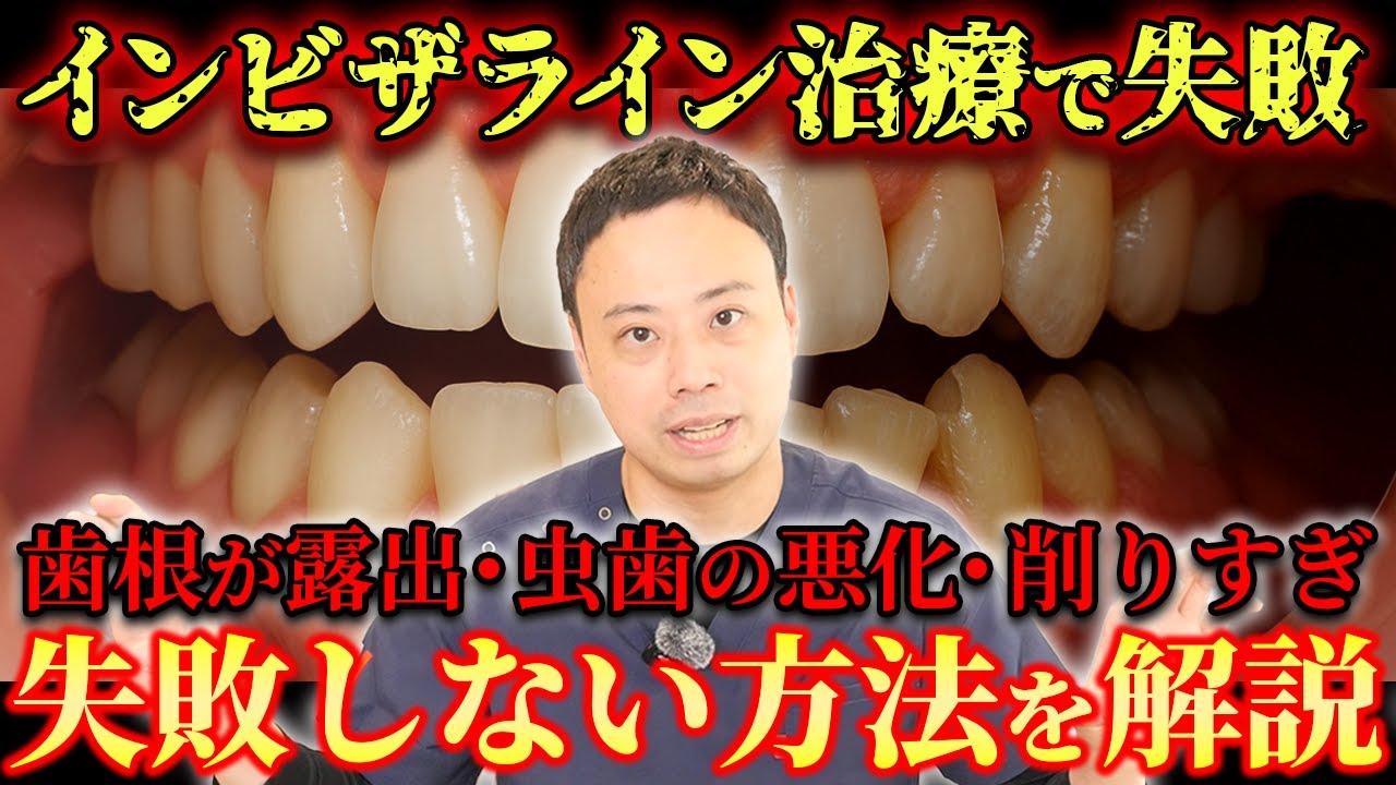 インビザライン矯正の失敗例を歯医者さんが徹底解説