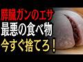 「病院で初めて気づくケースも」膵臓ガンと食べ物の関係とは？見直したい食習慣