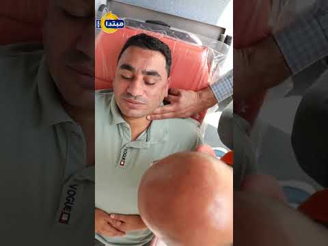 ما أسباب وعلاج الشرقة أثناء الأكل أخصائي يجيب