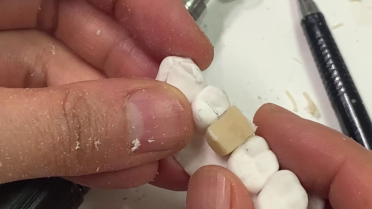 임플란트 소구치 싱글 조각 영상