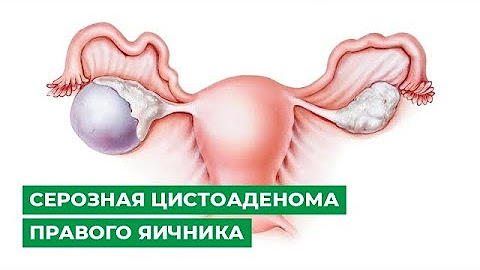 Гинекология (женское здоровье)
