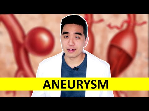 Video: 4 Mga Paraan upang Makita ang isang Aneurysm