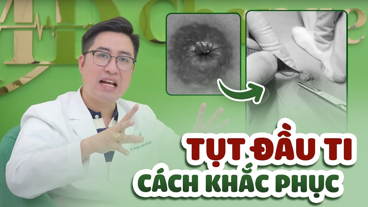 TỤT ĐẦU TI CÓ CHO CON BÚ ĐƯỢC KHÔNG?| CÁCH KHẮC PHỤC NHƯ THẾ NÀO? - YouTube