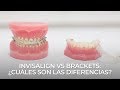 Diferencias entre Invisalign y Brackets - Clínica Silmidental