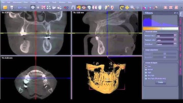 Dicom import and filter setting