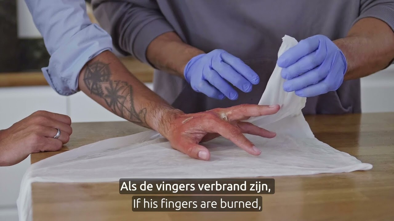 Brandwonde koelen + hand afdekken driehoeksverband en plastic folie