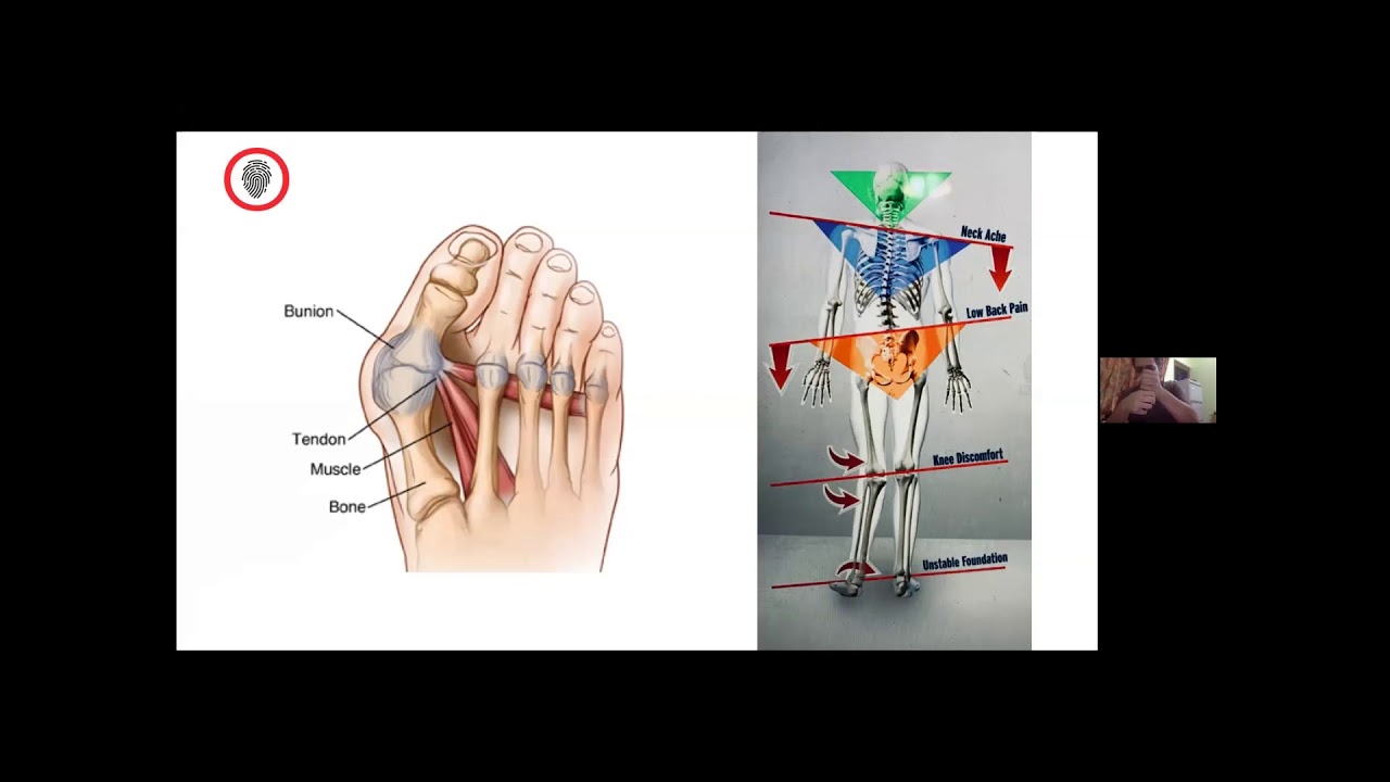 runner's world flat feet