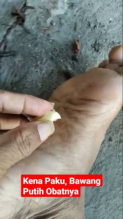Kena Paku Bawang Putih Obatnya,#shorts