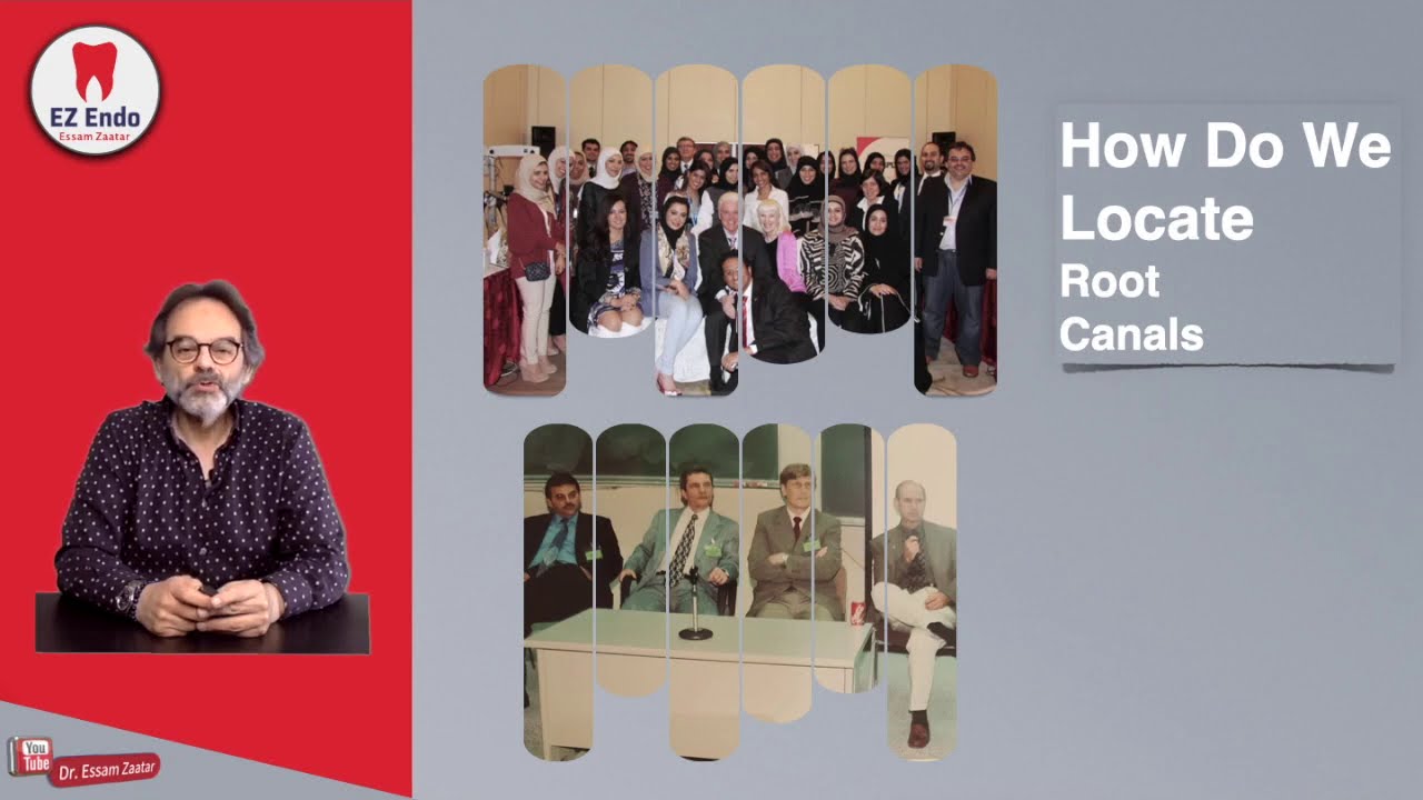 طرق تحديد قنوات الجذور - باللغة العربية Locating Root Canals - Arabic