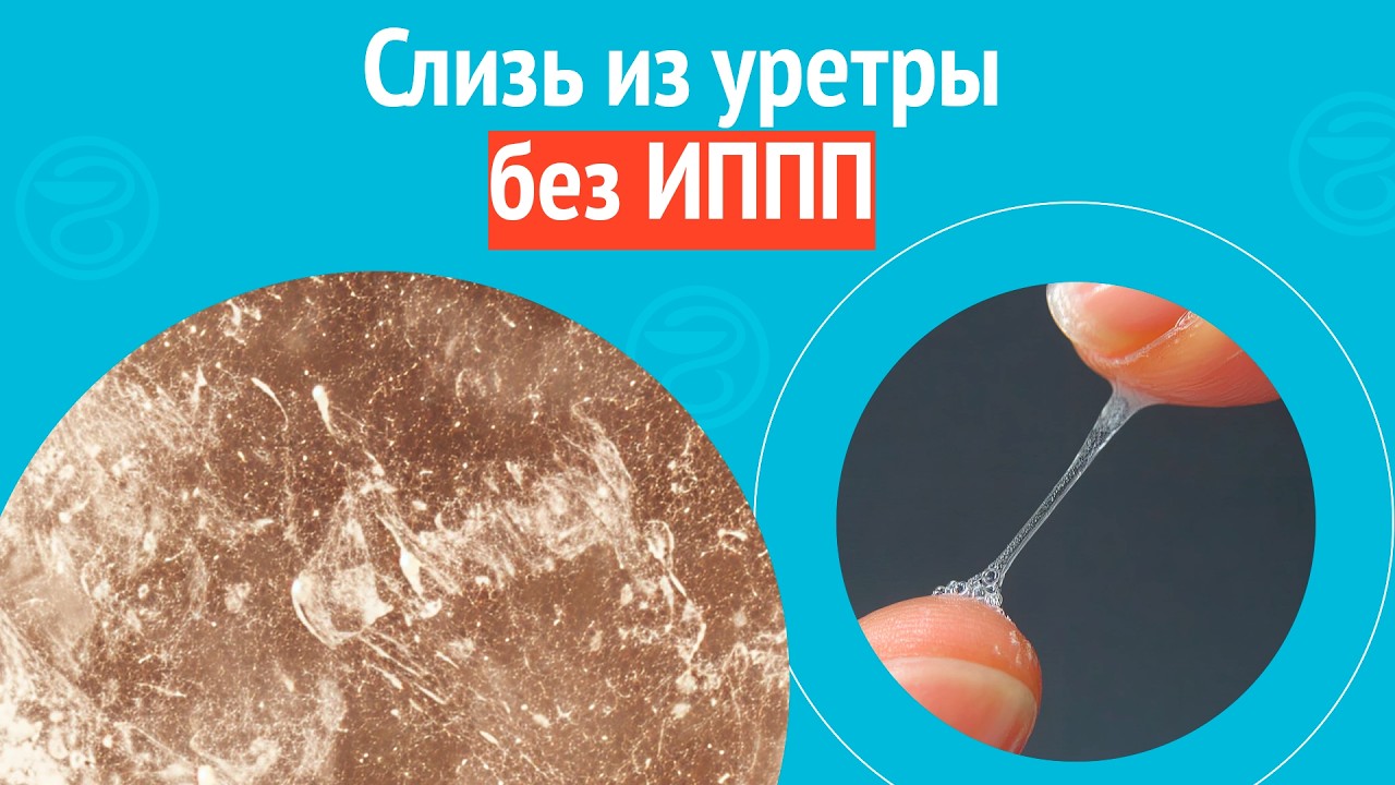 Во Время Секса Выделяется Белая Жидкость Во Время Секса Выделяется Белая Жидкость