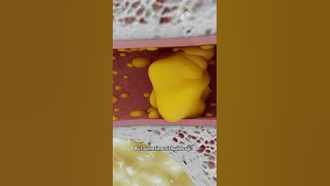 How to Remove Ear Wax Blockage the Right Way #shorts #facts - creativelearning3d