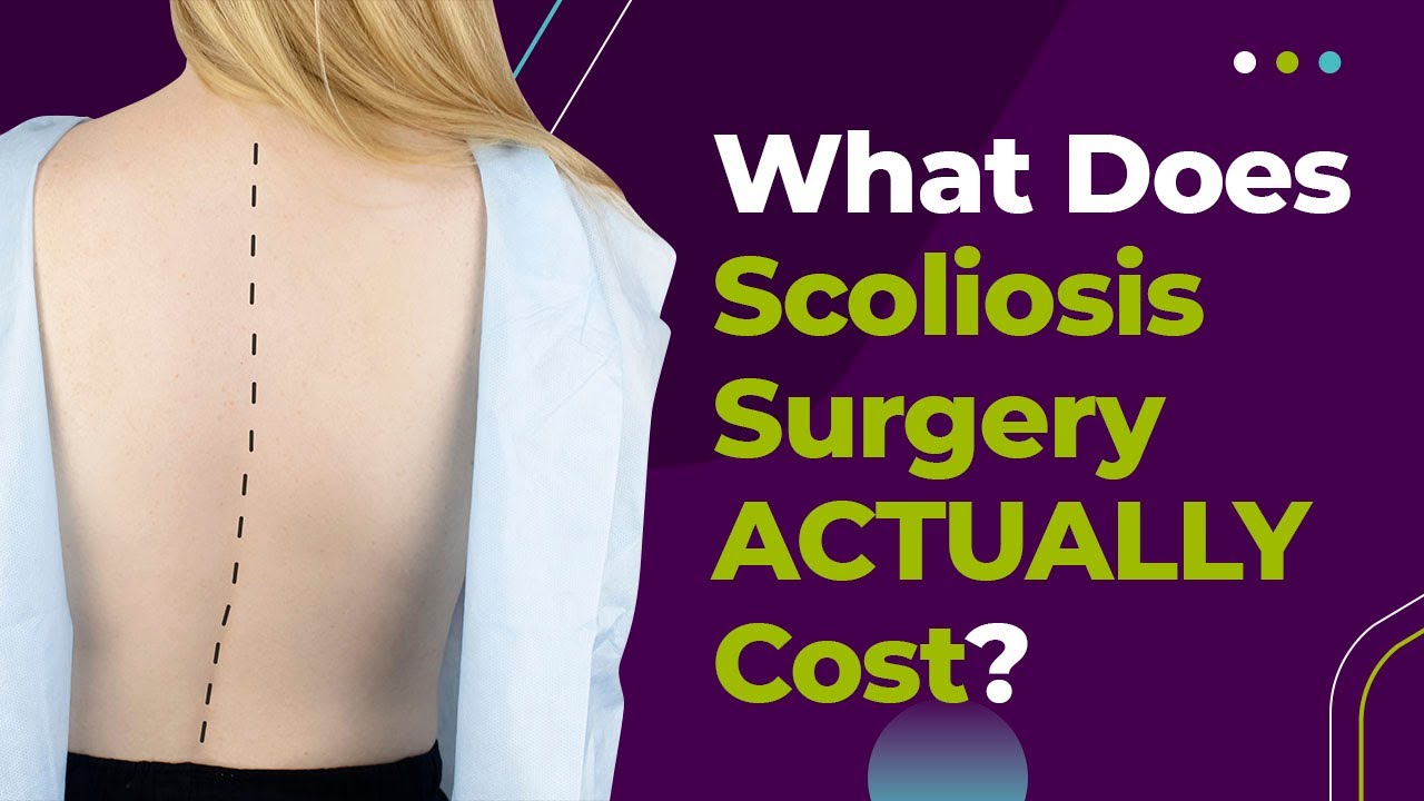 What Does Scoliosis Surgery ACTUALLY Cost? YouTube