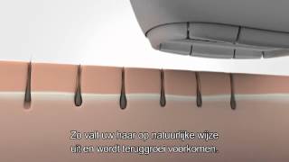 Philips Lumea: altijd een gladde huid! screenshot 5