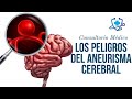 Los Peligros Del Aneurisma Cerebral 👨‍⚕️ Consultorio Médico