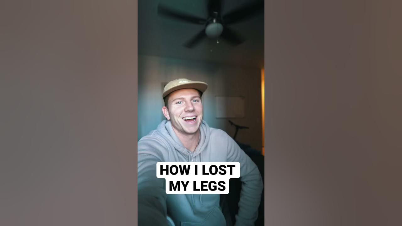mason-s-devastating-loss-the-shocking-truth-behind-his-missing-leg