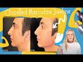 How To Get A Chiselled Masculine Jawline | Radiesse