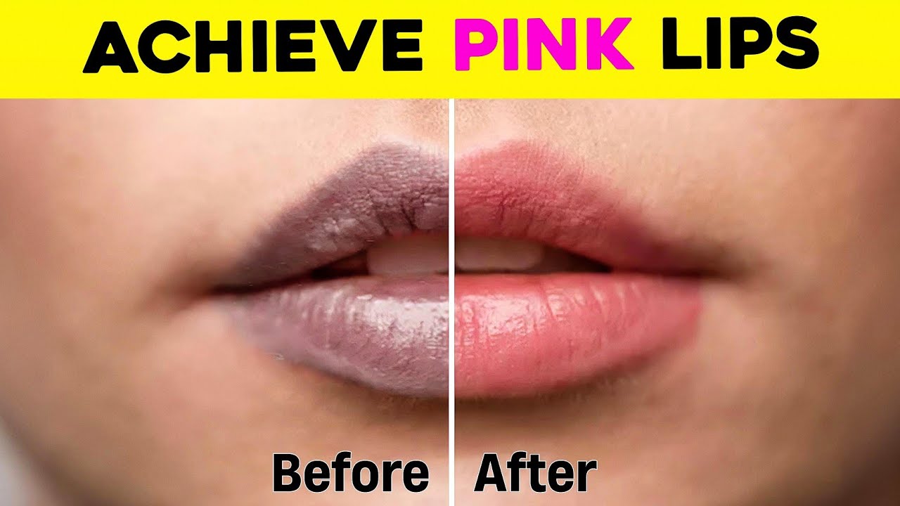 Get Pink, Healthy Lips in 30 Days *Naturally*