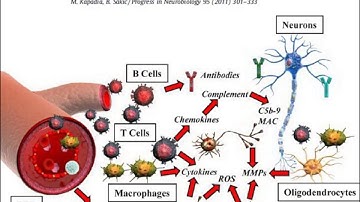 Multiple Sclerosis Webinar: Pediatric MS
