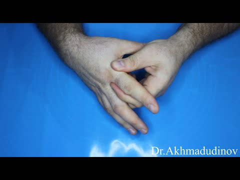 Видео: Артроза на ръцете