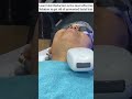 Laser Hair Removal In Delhi | Facial Hair Removal | Skin Hair & Laser Centre