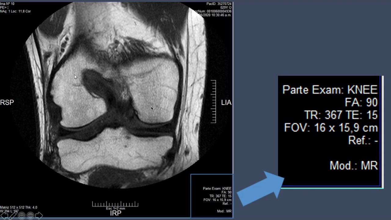 SECUENCIAS DE RESONANCIA EN MODO FACIL