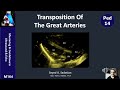 Transposition of the great arteries tga