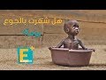 الجوع نهش بطون 820 مليون نسمة حول العالم خلال 2018