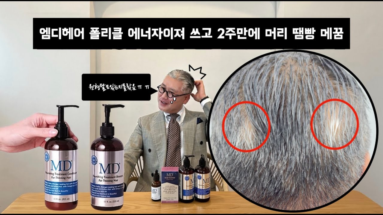 [몰아보기] 탈모 관련 엠디 두피앰플+엠디 샴푸 몰아보기