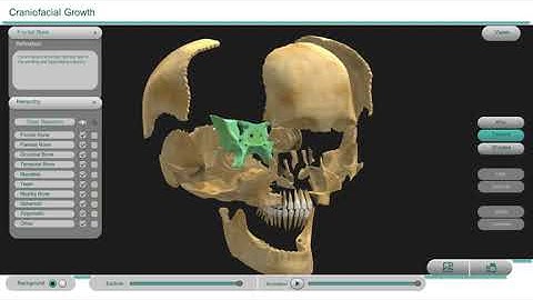chronic facial growth ! Medical ! 3d visualizer | unity 3d | e learning | 3d interactive
